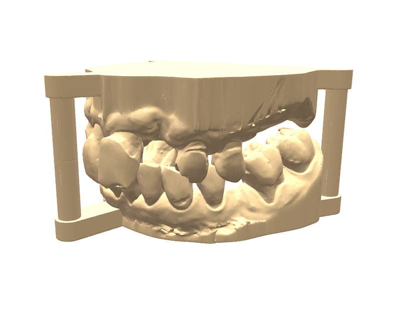 Modèle de travail + Antagoniste